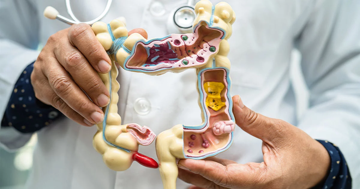 microbiota intestinale